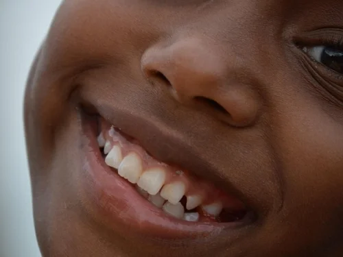 Dream Meaning: Falling into a Deep Pit with a Car in a Dream: Uncontrolled Descent, Hidden Fears